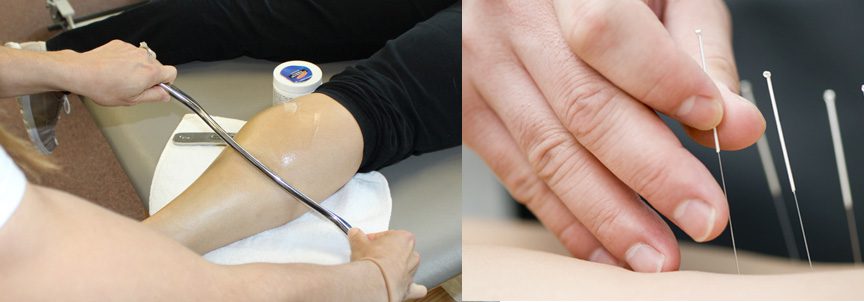 graston-dry-needling