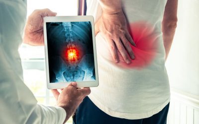 Low Back Pain and Imaging Explained