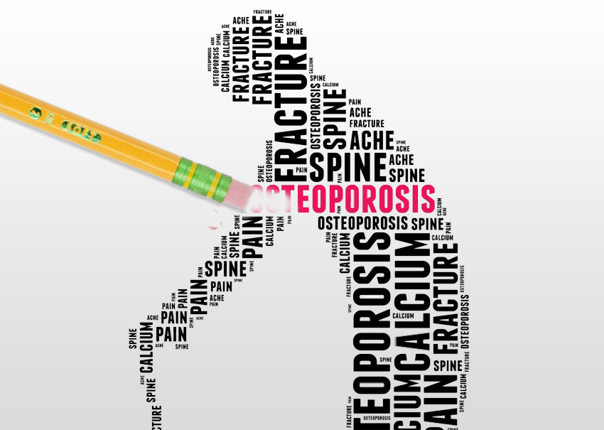 Hampton PT can help erase bone loss caused from osteoporosis