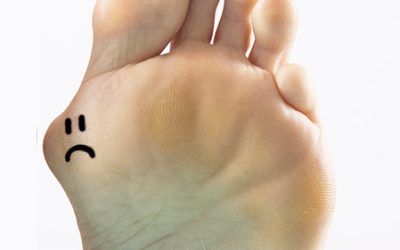 Bunions ~ Help For These Bothersome Bumps